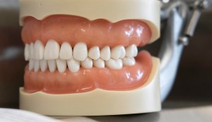denture model